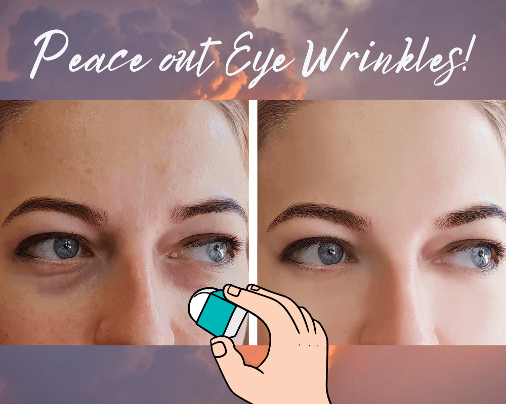 how to get rid of under eye wrinkles overnight